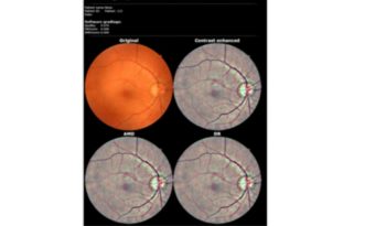 Fundus kamera Rodenstock „FundusScope” full