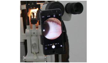 Adapter obrazowania oka do smartfona CTA-300 full