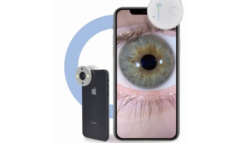 Adapter obrazowania oka do smartfona VPA-100 QuikVue full