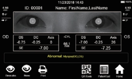 Autorefraktometr przenośny V100 Vision Screener full